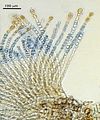 Hapalospongidion macrocarpum4